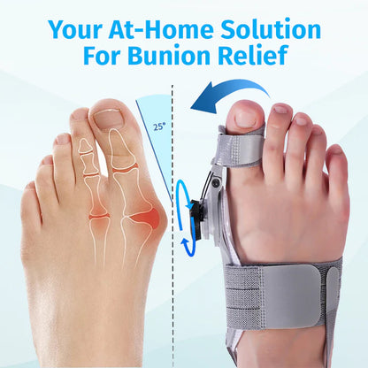 NordicMedix Bunion Fix