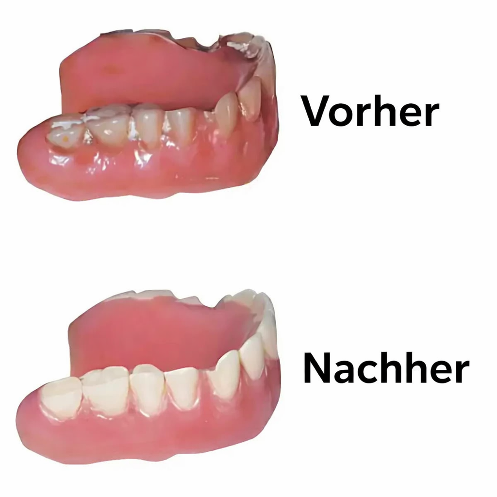 Denture CleanPro™ – Hygienische UV-C-Reinigung für Zahnprothesen
