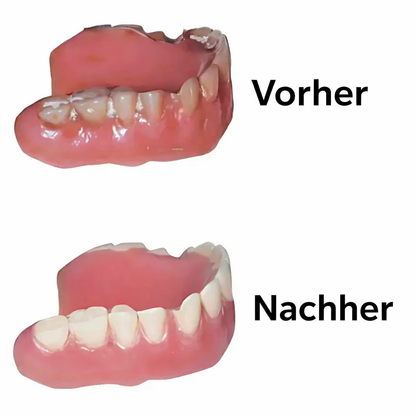 Denture CleanPro™ – Hygienische UV-C-Reinigung für Zahnprothesen