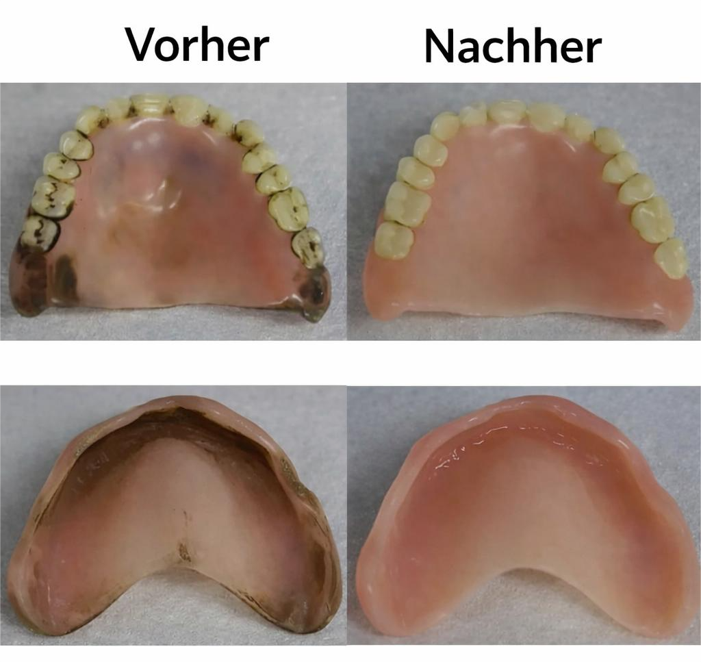 Denture CleanPro™ – Hygienische UV-C-Reinigung für Zahnprothesen