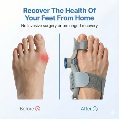 Bunion Fix